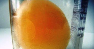 Bottle Egg –Trik Memasukkan Telur Ayam kedalam Botol - BintangTop.com